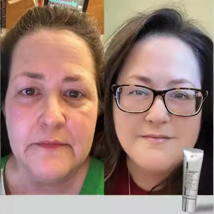 SmoothLift Eye Cream | Smoother-Looking Under-Eyes