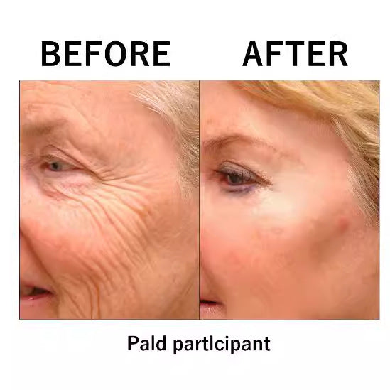 SmoothLift Eye Cream | Smoother-Looking Under-Eyes